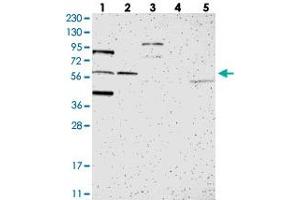 Western blot analysis of Lane 1: RT-4, Lane 2: U-251 MG, Lane 3: Human Plasma, Lane 4: Liver, Lane 5: Tonsil with C1orf116 polyclonal antibody . (C1orf116 anticorps)