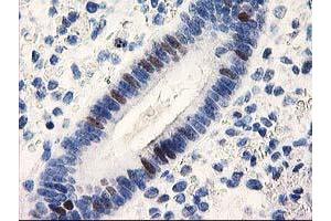 Image no. 2 for anti-Uracil-DNA Glycosylase (UNG) antibody (ABIN1501681)