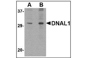 Western blot analysis of DNAL1 in 3T3 cell lysate with DNAL1 antibody at (A) 1 and (B) 2 µg/ml. (DNAL1 anticorps  (C-Term))