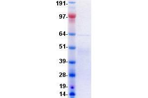 Validation with Western Blot