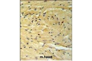 GNAT1 Antibody (C-term) (ABIN653740 and ABIN2843042) IHC analysis in formalin fixed and paraffin embedded moouse heart tissue followed by peroxidase conjugation of the secondary antibody and DAB staining. (GNAT1 anticorps  (C-Term))