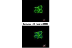 ICC/IF Image Immunofluorescence analysis of methanol-fixed A431, using Ladinin 1, antibody at 1:500 dilution. (Ladinin 1 anticorps  (C-Term))
