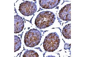 IHC analysis of LIN41/TRIM71 using anti-LIN41/TRIM71 antibody (ABIN7602565).