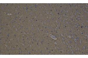 Immunohistochemistry analysis of paraffin-embedded mouse brain using GAP43 Polyclonal Antibody at dilution of 1:300. (GAP43 anticorps)