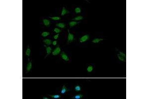 Immunofluorescence analysis of U2OS cells using PSMA1 Polyclonal Antibody at dilution of 1:100. (PSMA1 anticorps)