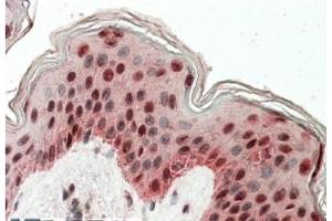 AP21273PU-N TIAL1 antibody staining of paraffin embedded Human Skin at 3. (TIAL1 anticorps  (Internal Region))