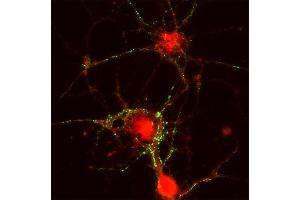 Immunocytochemistry (ICC) image for anti-Cell Adhesion Molecule 2 (CADM2) (AA 167-181) antibody (ABIN1742492)