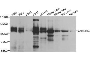 Western blot analysis of extracts of various cell lines, using ANKRD52 antibody. (ANKRD52 anticorps)