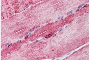 Human Skeletal muscle: Formalin-Fixed, Paraffin-Embedded (FFPE)
