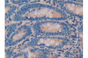 DAB staining on IHC-P; Samples: Rat Small intestine Tissue (ANGPTL2 anticorps  (AA 47-207))