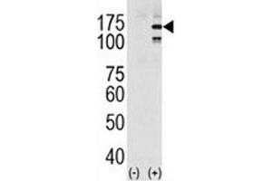 Western blot analysis of EGFR in HeLa cell lysate, either noninduced (Lane 1) or induced with EGF (2). (EGFR anticorps  (pTyr1069))