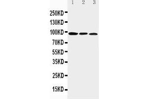 Anti-Aryl hydrocarbon Receptor antibody,  Western blotting Lane 1: Mouse Brain Tissue Lysate Lane 2: Mouse Heart Tissue Lysate Lane 3: Mouse Liver Tissue Lysate