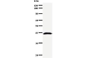 Western Blotting (WB) image for anti-Cyclin D Binding Myb-Like Transcription Factor 1 (DMTF1) antibody (ABIN930913)