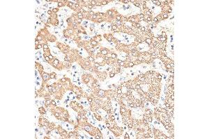 Immunohistochemistry of paraffin-embedded human liver using KIR3DS1 antibody. (KIR3DS1 anticorps  (AA 80-340))