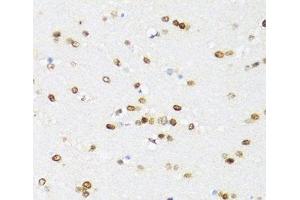 Immunohistochemistry of paraffin-embedded Mouse brain using DDX21 Polyclonal Antibody at dilution of 1:100 (40x lens). (DDX21 anticorps)