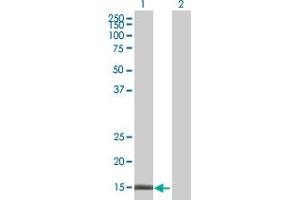 Lane 1: BZRP transfected lysate ( 18.