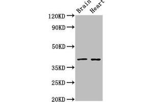 Western Blot Positive WB detected in: Rat brain tissue, Rat heart tissue All lanes: CERS1 antibody at 3 μg/mL Secondary Goat polyclonal to rabbit IgG at 1/50000 dilution Predicted band size: 40, 38 kDa Observed band size: 40 kDa