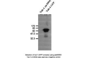 Image no. 1 for anti-Tubby Homolog (TUB) antibody (ABIN363362) (TUB anticorps)