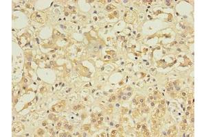 Immunohistochemistry of paraffin-embedded human adrenal gland tissue using ABIN7148084 at dilution of 1:100