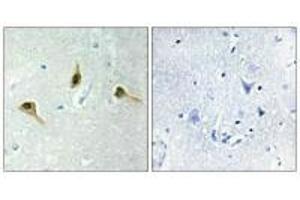 Immunohistochemistry analysis of paraffin-embedded human brain tissue using MSH2 antibody. (MSH2 anticorps)