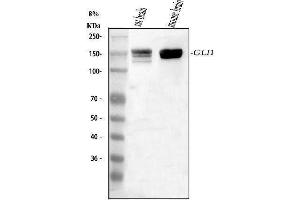 Western blot analysis of GLI1 using anti-GLI1 antibody (ABIN7602517).
