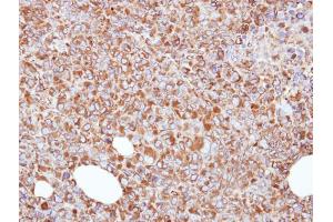 IHC-P Image Immunohistochemical analysis of paraffin-embedded H1299 xenograft, using ERp57, antibody at 1:500 dilution.