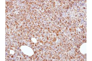 IHC-P Image Immunohistochemical analysis of paraffin-embedded H1299 xenograft, using ERp57, antibody at 1:500 dilution. (PDIA3 anticorps  (C-Term))