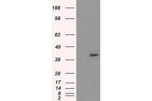 Image no. 2 for anti-Protein Phosphatase Methylesterase 1 (PPME1) antibody (ABIN1500298) (PPME1 anticorps)