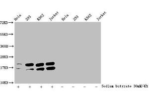 Western Blot Detected samples: Hela whole cell lysate, 293 whole cell lysate, K562 whole cell lysate, Jurkat whole cell lysate, Untreated (-) or treated (+) with 30 mM sodium butyrate for 4h All lanes: HIST1H1C antibody at 1:2000 Secondary Goat polyclonal to rabbit IgG at 1/40000 dilution Predicted band size: 22 kDa Observed band size: 22 kDa (HIST1H1C anticorps  (acLys96))