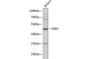 Western blot analysis of extracts of SKOV3 cells, using EGR3 antibody (ABIN6127828, ABIN6139993, ABIN6139994 and ABIN6223592) at 1:1000 dilution. (EGR3 anticorps  (AA 1-250))