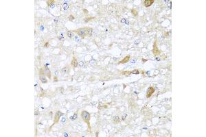 Immunohistochemistry of paraffin-embedded rat brain using CBR4 antibody (ABIN5972931) at dilution of 1/100 (40x lens). (CBR4 anticorps)