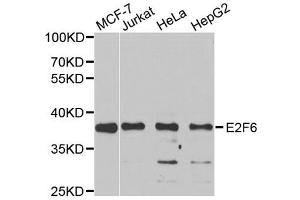 Western blot analysis of extracts of various cell lines, using E2F6 antibody. (E2F6 anticorps)