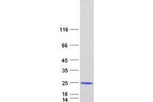 Validation with Western Blot