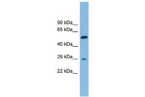 WB Suggested Anti-TM4SF20 Antibody Titration: 0. (TM4SF20 anticorps  (Middle Region))