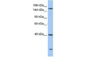 Carboxypeptidase D antibody used at 1 ug/ml to detect target protein.
