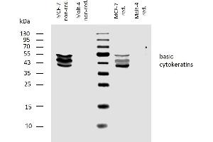 Western blotting analysis of human basic cytokeratins using mouse monoclonal antibody AE3 on lysates of MCF-7 cell line and Molt-4 cell line (cytokeratin non-expressing cell line, negative control) under non-reducing and reducing conditions. (Keratin Basic anticorps)