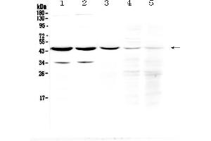 Western blot analysis of HOMER3 using anti-HOMER3 antibody . (HOMER3 anticorps  (AA 282-360))
