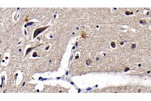 Detection of TLR3 in Porcine Cerebrum Tissue using Polyclonal Antibody to Toll Like Receptor 3 (TLR3)