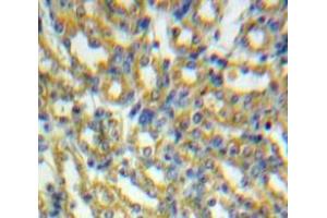 Used in DAB staining on fromalin fixed paraffin-embedded Kidney tissue (HSPD1 anticorps  (AA 28-573))