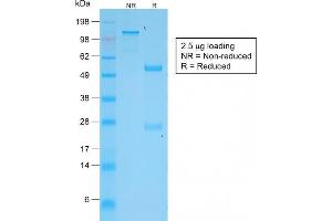 SDS-PAGE Analysis Purified VEGI Rabbit Monoclonal Antibody (VEGI /2052R).