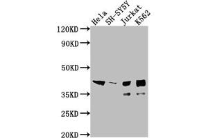 Western Blot Positive WB detected in: Hela whole cell lysate, SH-SY5Y whole cell lysate, Jurkat whole cell lysate, K562 whole cell lysate All lanes: ISL1 antibody at 1:2000 Secondary Goat polyclonal to rabbit IgG at 1/50000 dilution Predicted band size: 40 kDa Observed band size: 39 kDa (Recombinant ISL1 anticorps)