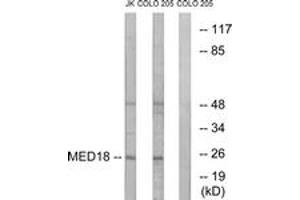 Western blot analysis of extracts from COLO/Jurkat cells, using MED18 Antibody. (MED18 anticorps  (AA 70-119))