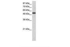 Image no. 1 for anti-Zinc Finger Protein 416 (ZNF416) (AA 90-139) antibody (ABIN202795) (ZNF416 anticorps  (AA 90-139))