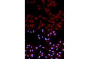 Immunofluorescence analysis of U2OS cell using Phospho-MAPK14-Y182-p antibody. (MAPK14 anticorps  (pTyr182))