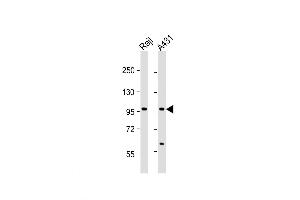 Western Blot at 1:1000 dilution Lane 1: Raji whole cell lysate Lane 2: A431 whole cell lysate Lysates/proteins at 20 ug per lane. (NFKB1 anticorps  (AA 911-939))