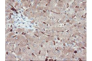 Image no. 2 for anti-serpin Peptidase Inhibitor, Clade B (Ovalbumin), Member 1 (SERPINB1) (AA 77-306) antibody (ABIN1491670)