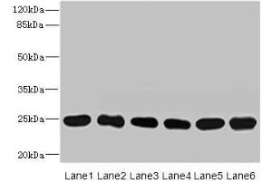 Western blot All lanes: FKBP14 antibody at 1 μg/mL Lane 1: Mouse stomach tissue Lane 2: Mouse gonadal tissue Lane 3: U937 whole cell lysate Lane 4: PC-3 whole cell lysate Lane 5: 293T whole cell lysate Lane 6: THP-1 whole cell lysate Secondary Goat polyclonal to rabbit IgG at 1/10000 dilution Predicted band size: 25 kDa Observed band size: 25 kDa (FKBP14 anticorps  (AA 20-211))
