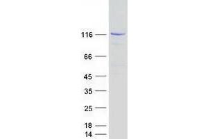 Validation with Western Blot
