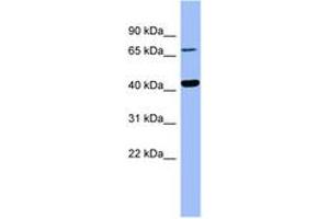 Image no. 1 for anti-4-Hydroxyphenylpyruvate Dioxygenase (HPD) (AA 179-228) antibody (ABIN6741738) (HPD anticorps  (AA 179-228))