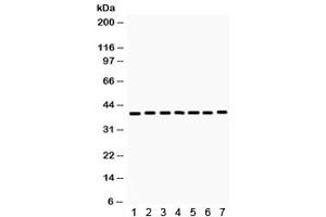 Western blot testing of  rat 1) skeletal muscle, 2) kidney, 3) heart, 4) NRK, and human 5) 293, 6) HeLa and 7) MCF7 lysate with HDAC11 antibody.